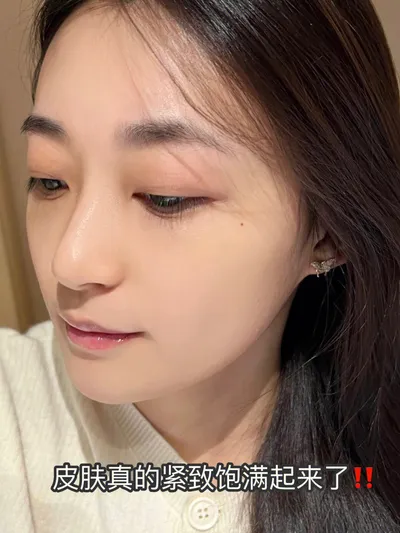 敏感肌肤长小疙瘩怎么办？有效护肤技巧分享！