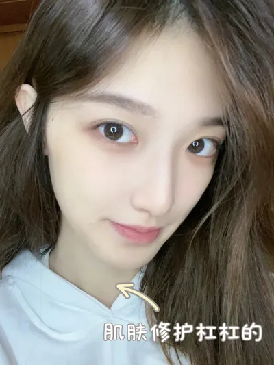 干性皮肤适合用晒后修护美容油吗