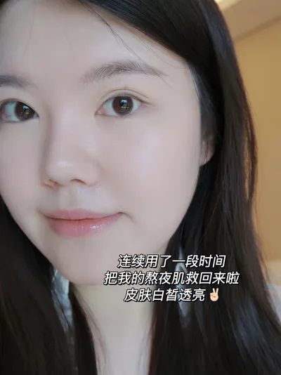 抗氧抗老精华能缓解高铁干燥肌肤吗？